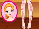 Barbie Bacak Doktoru Oyna