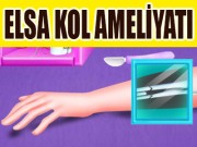 Prenses Elsa Kol Ameliyatı Oyna